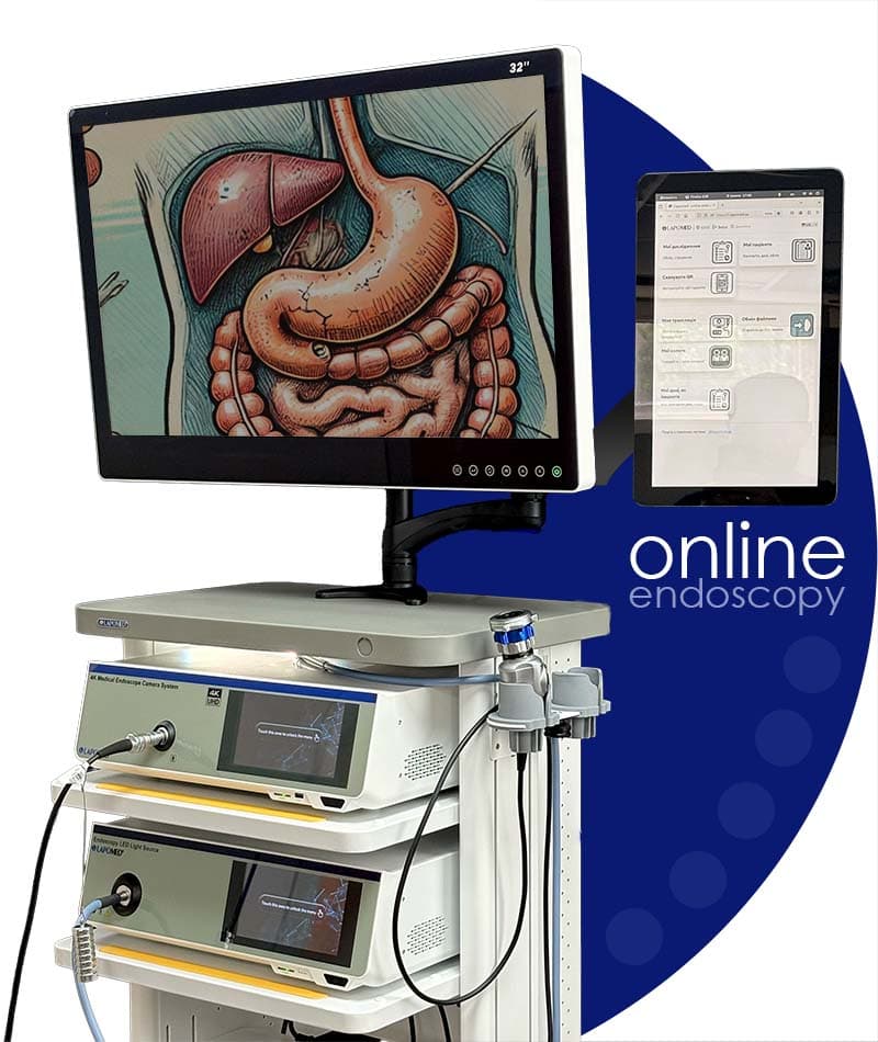 i.lapomed - онлайн ендоскопія